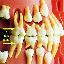 Gebisswechsel.JPG (87755 Byte)